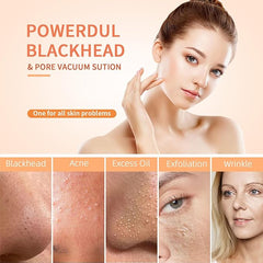 Blackhead Remover 6 in 1 Rechargeable